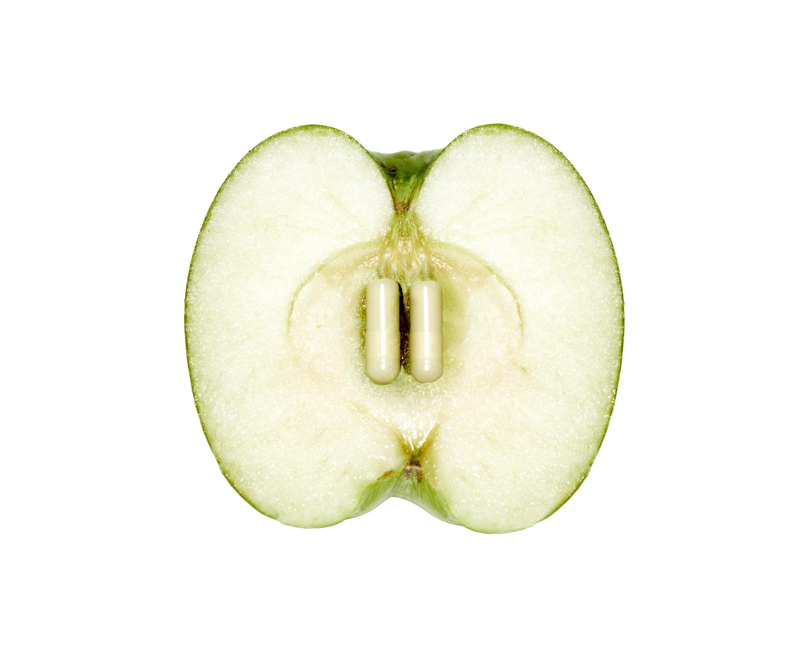 Malbouffe Ludovic Alussi