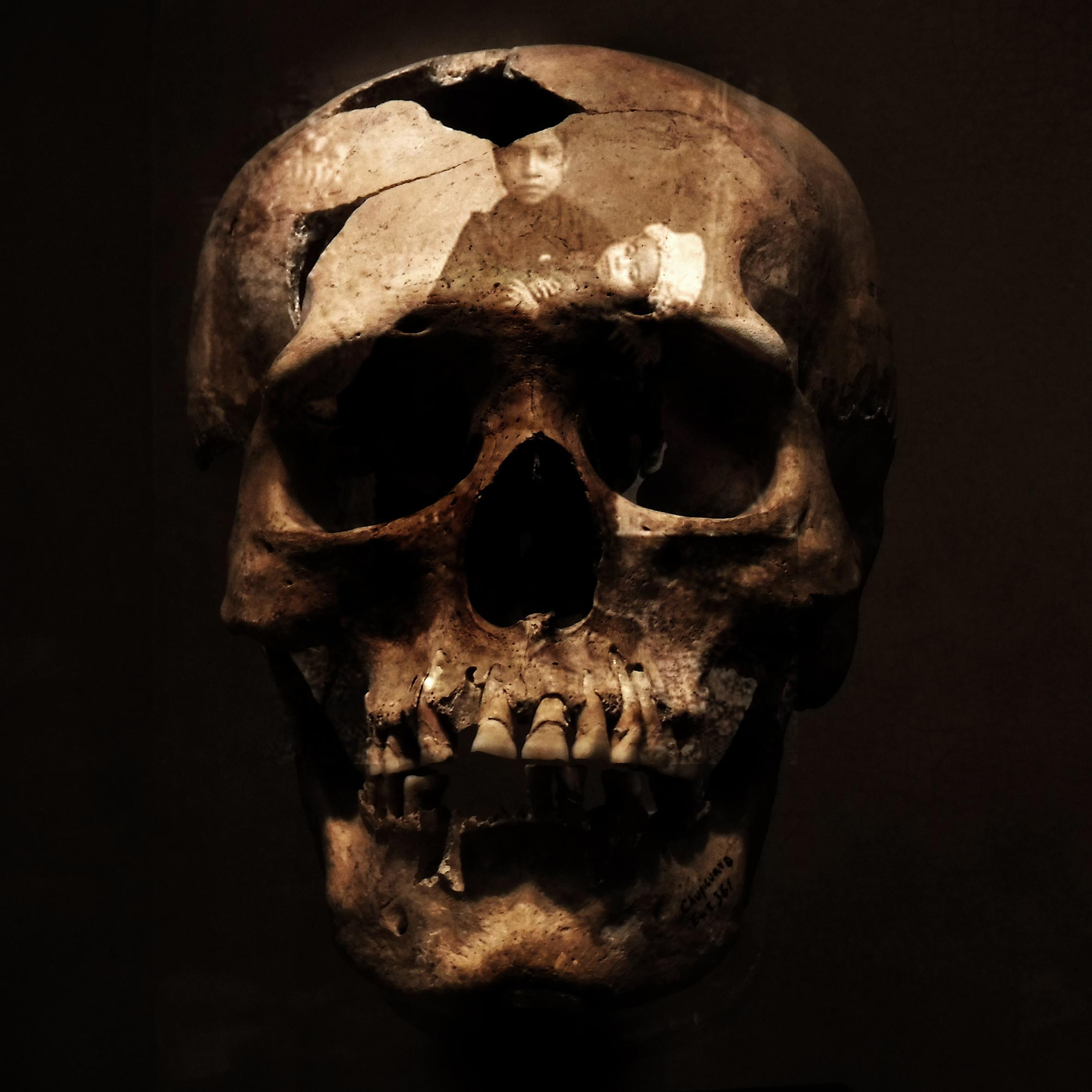 Calaveras Patrick Bard