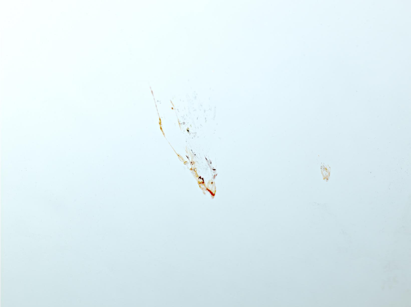 L'accident Laurent Monlaü