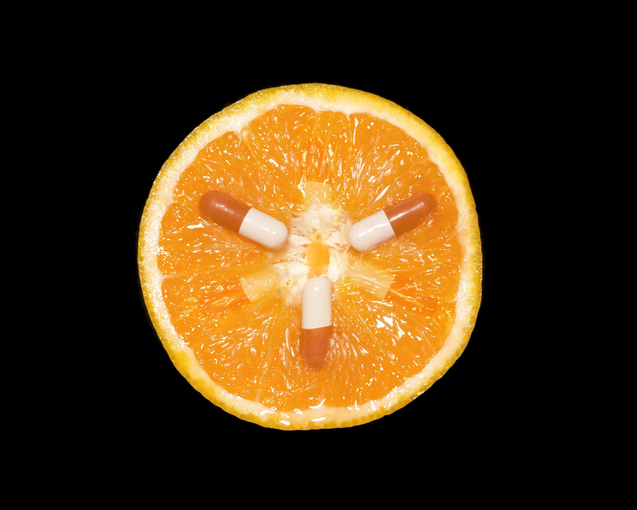 Malbouffe Ludovic Alussi