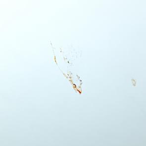 L'accident Laurent Monlaü